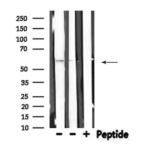 Polyclonal Rabbit anti-Human THBD / CD141 / Thrombomodulin Antibody (IF, WB)