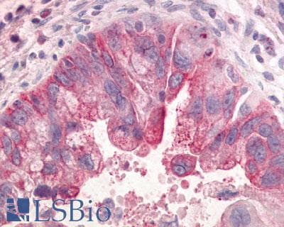 PathPlus™ GPR31 Antibody (Extracellular Domain)