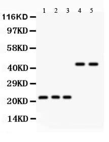 Polyclonal Rabbit anti-Human GPX1 / Glutathione Peroxidase Antibody (aa116-146, IHC, WB)