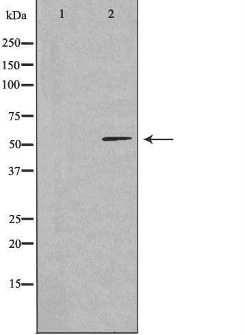 CCDC102A Antibody