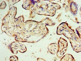 MTMR14 Antibody (aa1-280)