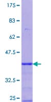 Human PGRMC1 / MPR Protein (Recombinant GST, N-terminus)