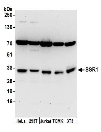 SSR1 Antibody (aa75-125)