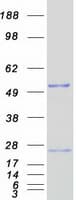 Human NUDT12 Protein (Recombinant Myc-DDK (Flag))