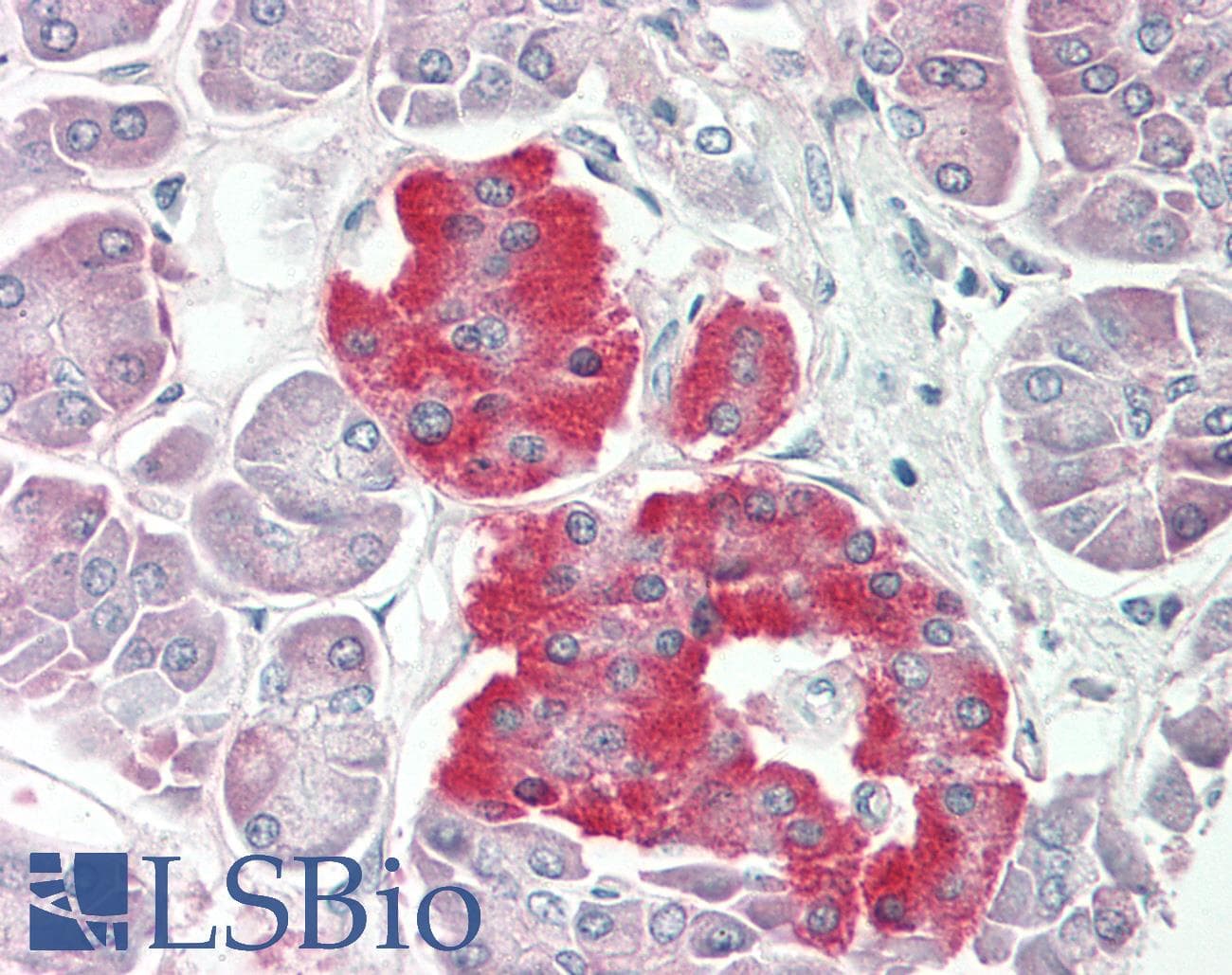 Polyclonal Rabbit anti-Mouse PDX1 Antibody (aa36-85, IHC, WB)