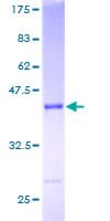Human SNX3 Protein (Recombinant GST)