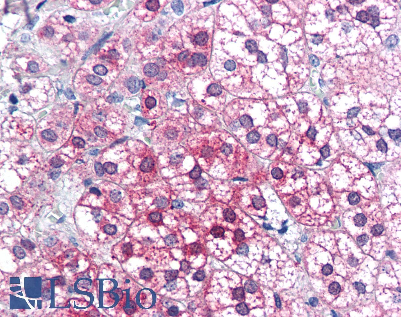 IHC-plus™ AXIN1 / Axin-1 Antibody (aa850-862)