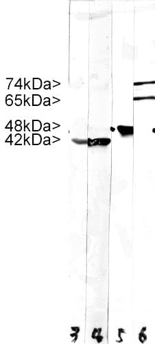 LMNA / Lamin A+C Antibody (clone 4C4)