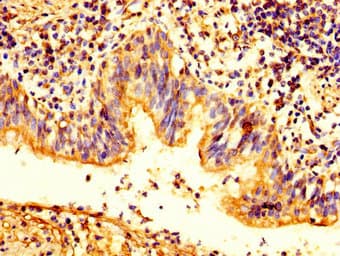 PKP2 / Plakophilin 2 Antibody