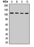 Polyclonal Rabbit anti-Human TFIP11 Antibody (WB)