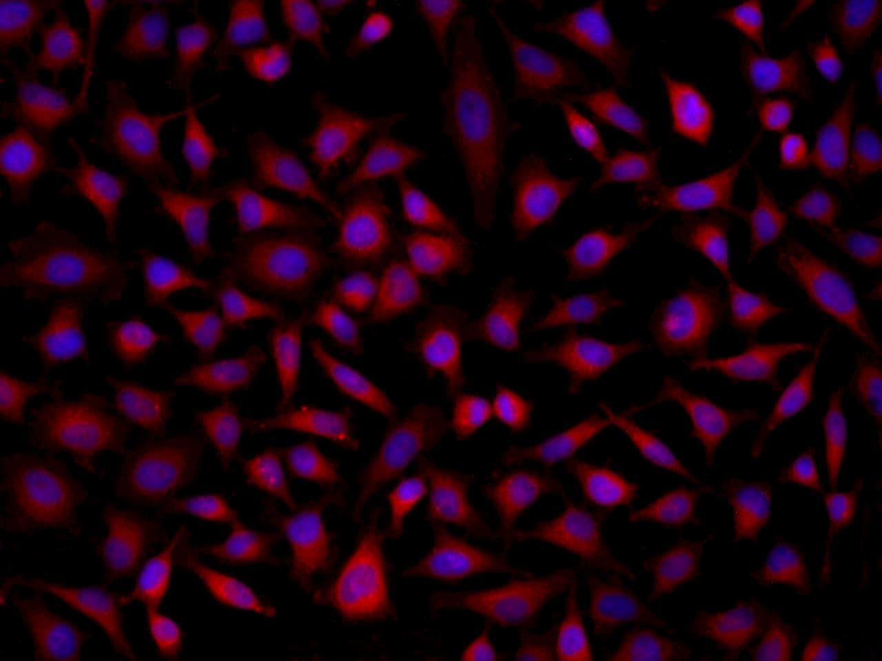 SOAT2 Antibody