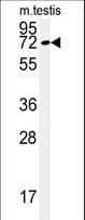 IHC-plus™ Polyclonal Rabbit anti-Human KLHL9 Antibody (aa299-326, IHC, WB)