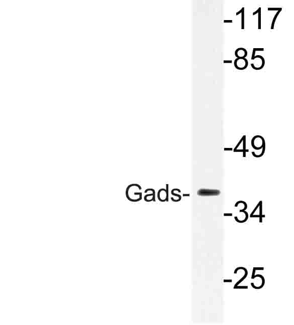 GRAP2 / GRID Antibody (Asn158)