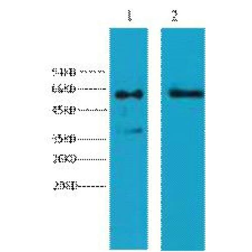 Monoclonal Mouse anti-Human KRT6 / CK6 / Cytokeratin 6 Antibody (clone 4A1, WB)