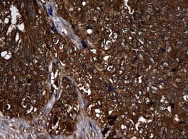 NME1 / NM23 Antibody (clone OTI1D12)
