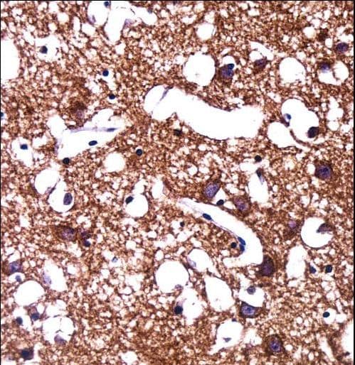 HCN1 Antibody (aa860-889)