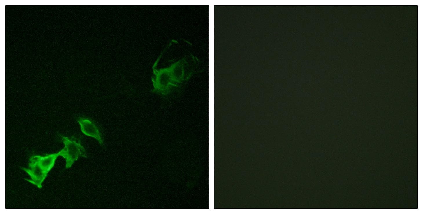 ABL1 / c-ABL Antibody (phospho-Tyr393/412)