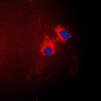 Polyclonal Rabbit anti-Human CDKN2B / p15 INK4b Antibody (C-Terminus, IHC, IF, WB)