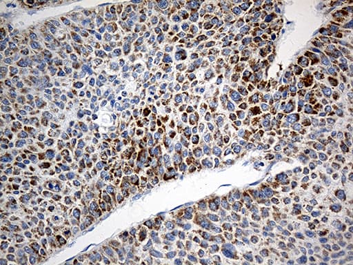 Monoclonal Mouse anti-Human TOMM40 / TOM40 Antibody (clone OTI9A3, IHC, WB)