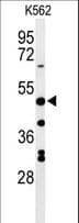 RHBG Antibody (aa423-450)
