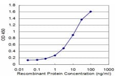 IHC-plus™ TROVE2 Antibody (clone 2B4)