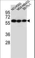 IHC-plus™ CHRNA10 Antibody (aa179-206)