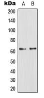 GCGR / Glucagon Receptor Antibody (Internal)
