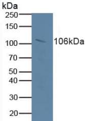 RB1 / Retinoblastoma / RB Antibody (aa639-778, PE)