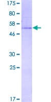 Human CHMP1A Protein (Recombinant GST)