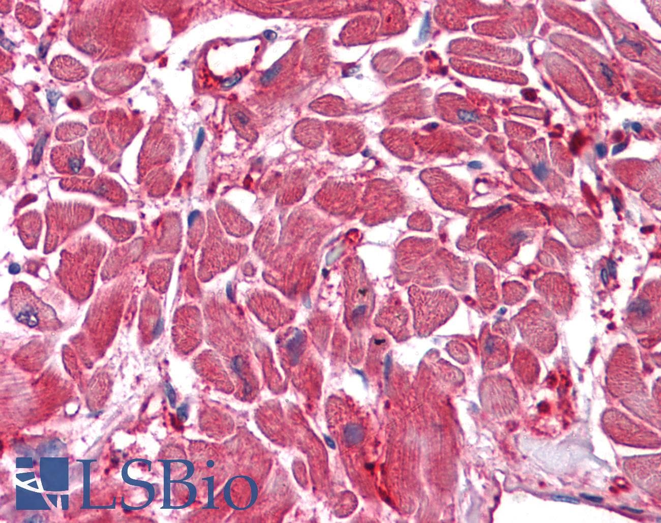 IHC-plus™ Monoclonal Mouse anti-Human ACOT9 Antibody (clone 4E4, IHC, IF, WB)