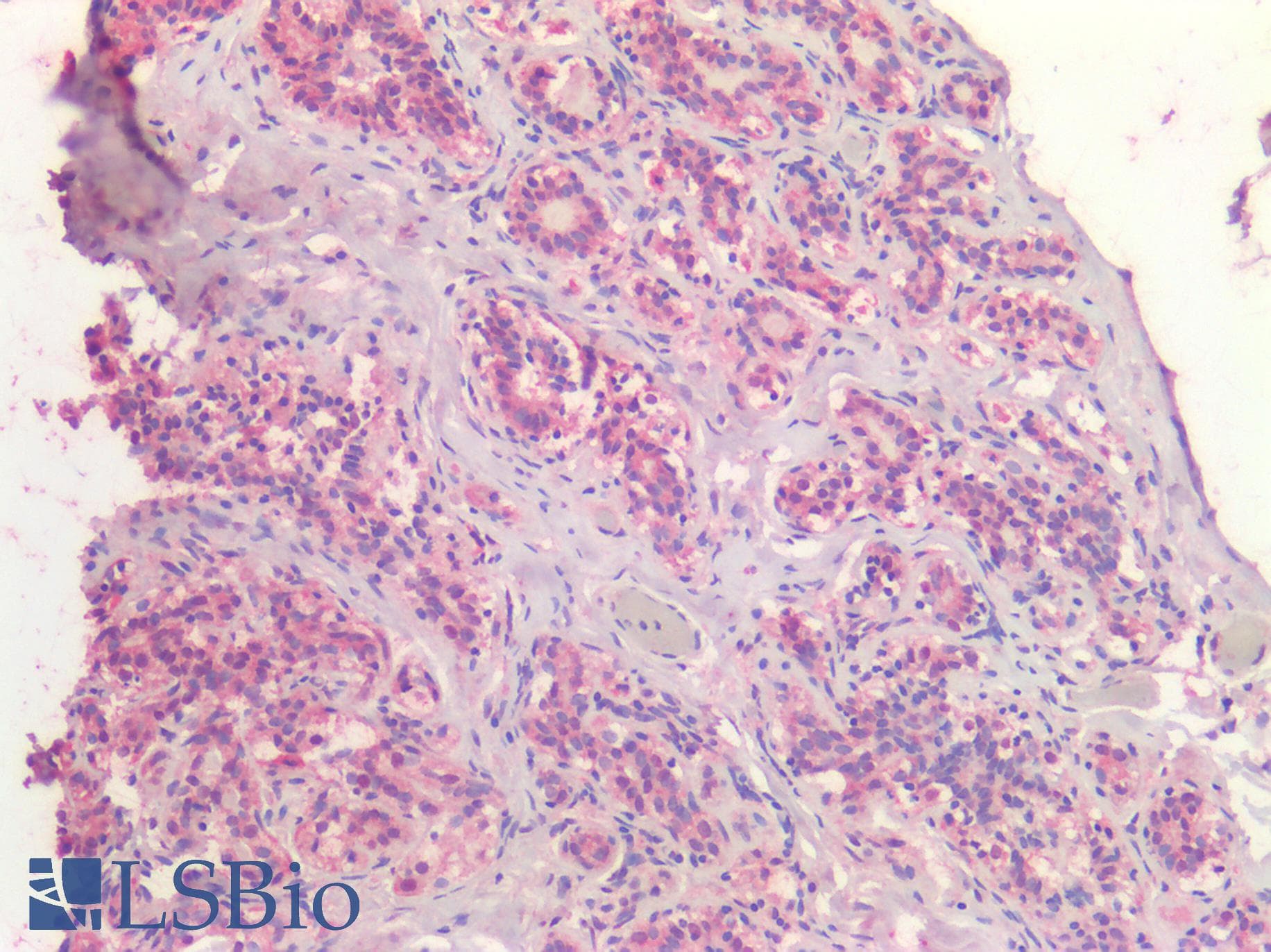 PathPlus™ ER Alpha / Estrogen Receptor Antibody (C-Terminus)
