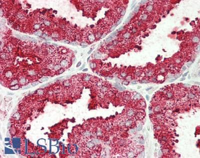 CPT1A Antibody (aa191-353)
