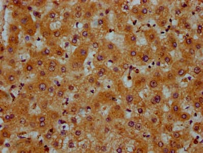 Polyclonal Rabbit anti-Human PRDM11 Antibody (IHC, IF, WB)
