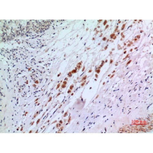IFNAR2 Antibody (N-Terminal)