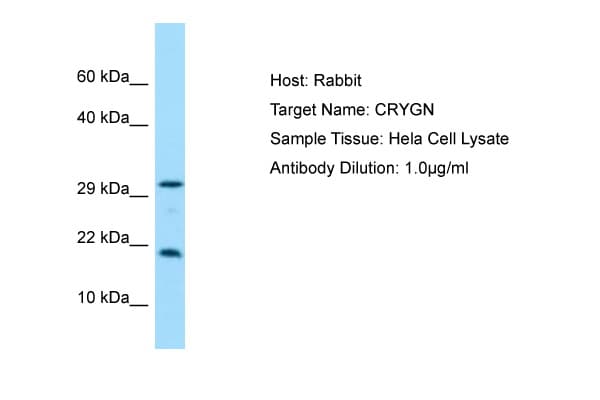 CRYGN Antibody (C-Terminus)