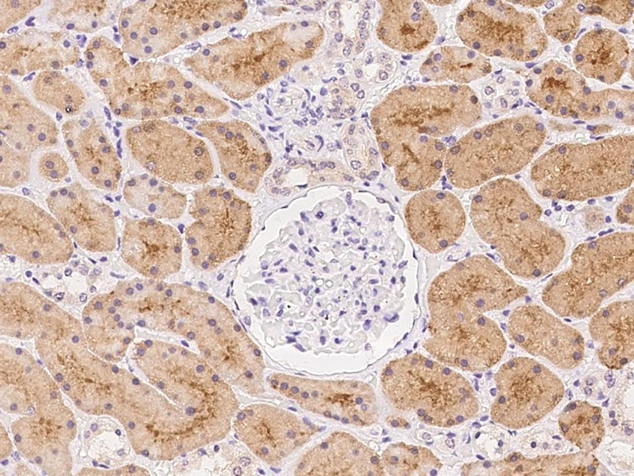 KLHL17 Antibody