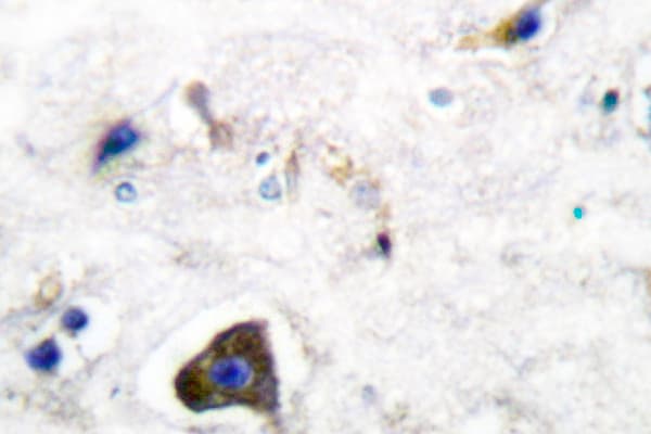 GFRA1 / GFR Alpha Antibody (Lys90)