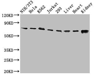 RIPK1 / RIP Antibody
