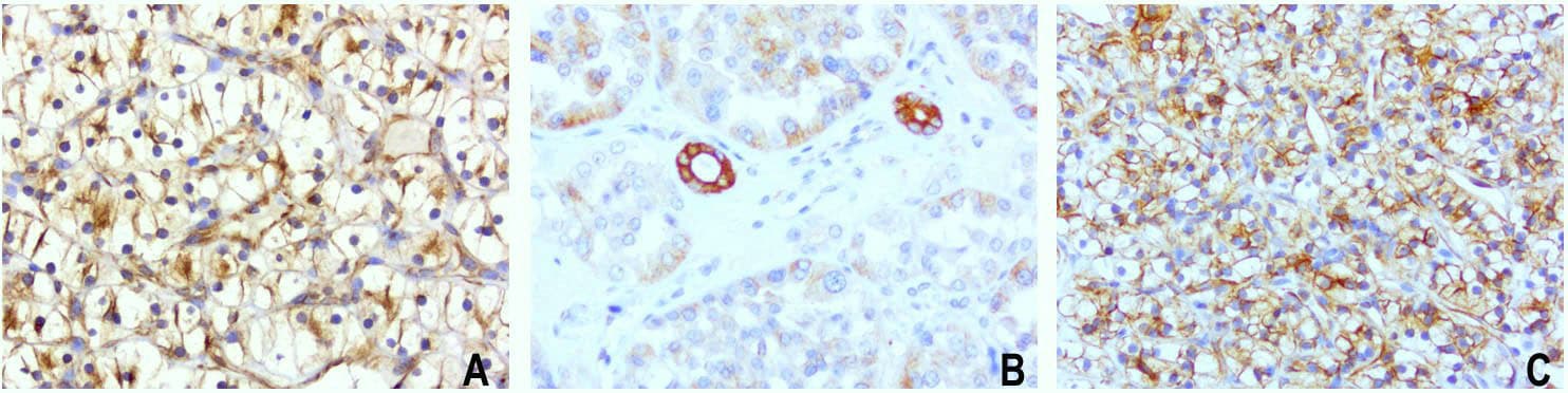 Monoclonal Mouse anti-Human CDH2 / N Cadherin Antibody (clone UMAB23, IHC, IF, WB)