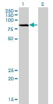LIMK2 Antibody (clone 2H2-E11)