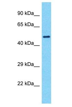 Polyclonal Rabbit anti-Human SMTNL1 Antibody (aa82-131, WB)