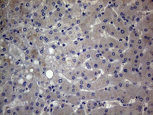GC / Vitamin D-Binding Protein Antibody (clone OTI2A1)