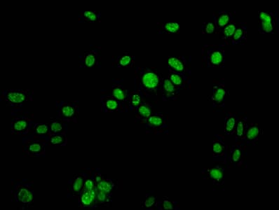 Polyclonal Rabbit anti-Human H2AFX / H2AX Antibody (phospho-Tyr142, IF)