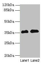 RFPL3 Antibody