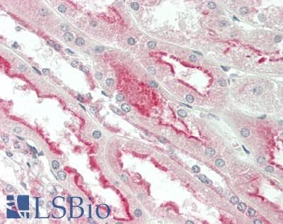 IHC-plus™ Polyclonal Rabbit anti-Human PPT1 / CLN1 Antibody (aa189-217, IHC, WB)