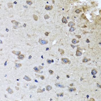 Polyclonal Rabbit anti-Human BRCA1 Antibody (IHC, IF, WB)