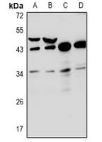 Polyclonal Rabbit anti-Human RNF144B Antibody (WB)