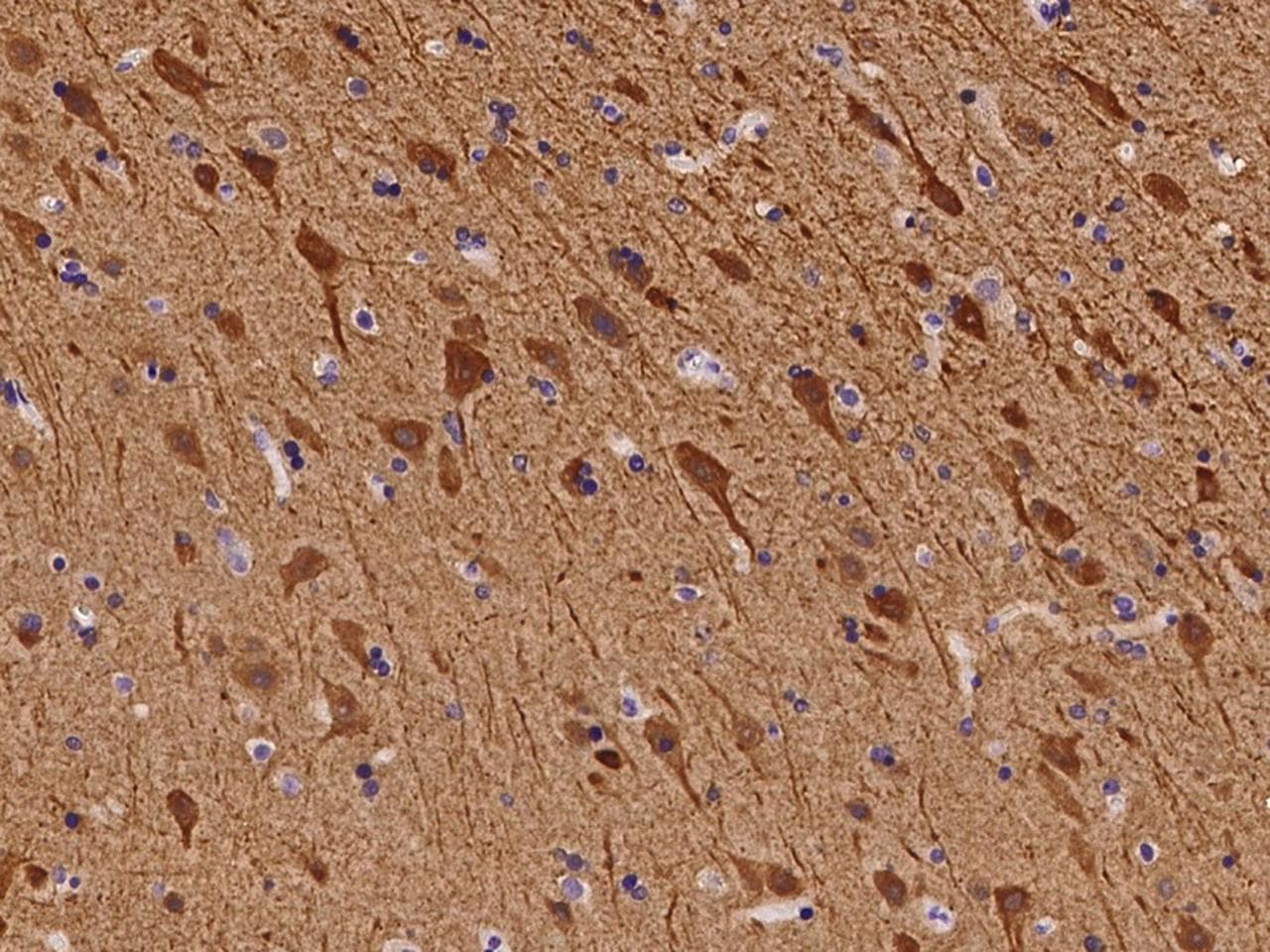 NECAB1 Antibody