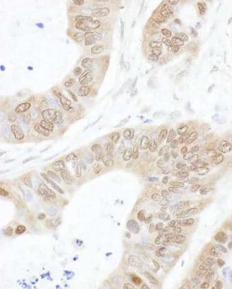 Polyclonal Rabbit anti-Human USP14 Antibody (aa350-400, IHC, WB)