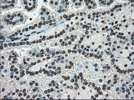 Monoclonal Mouse anti-Human MKI67 / Ki67 Antibody (clone OTI3D11, IHC, WB)